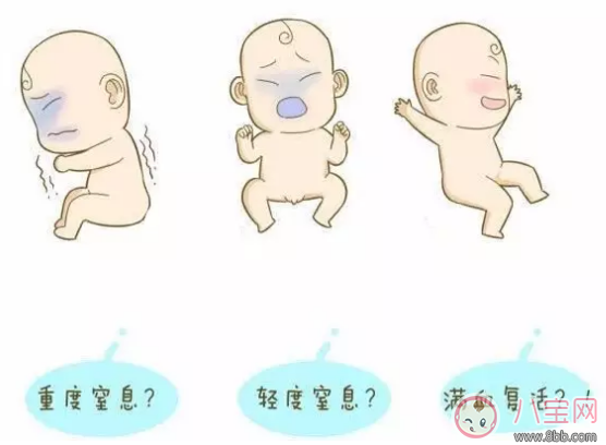 生产后的宝宝出生后去哪了    宝宝出生后就被抱走是为什么
