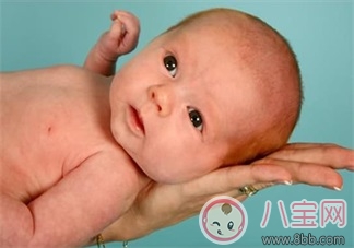 婴儿常见皮肤问题怎么解决     尿布疹湿疹乳痂解决方法