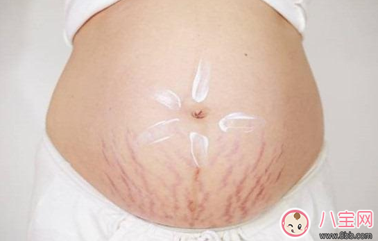 长妊娠纹用什么妊娠纹霜好 妊娠纹霜测评推荐