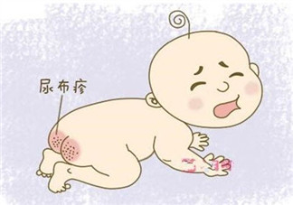 婴儿长尿布疹怎么办 尿布疹是怎么引起的