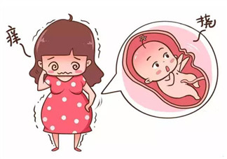孕晚期肚皮痒怎么办 孕晚期肚皮痒怎么缓解