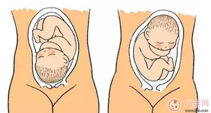 孕晚期胎位不正怎么办 孕晚期胎位图