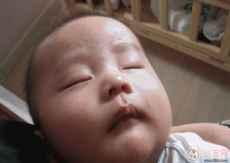 宝宝痱子和湿疹的区别 宝宝湿疹和痱子最大的不同是什么