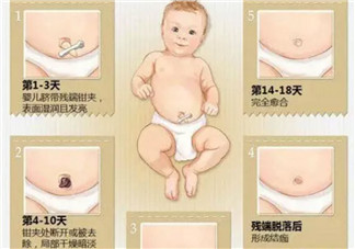 新生儿脐带脱落的时间是几天 新生儿脐带脱落的过程图解