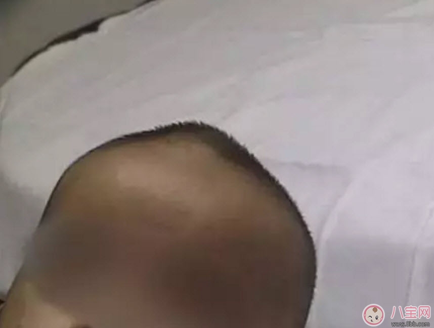 新生儿的头可以摸吗 为什么婴儿的头不能摸