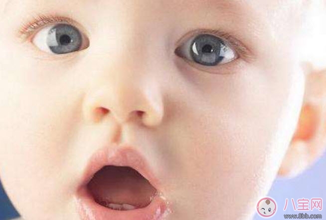 宝宝嘴角边长湿疹怎么办 宝宝嘴角湿疹是什么原因