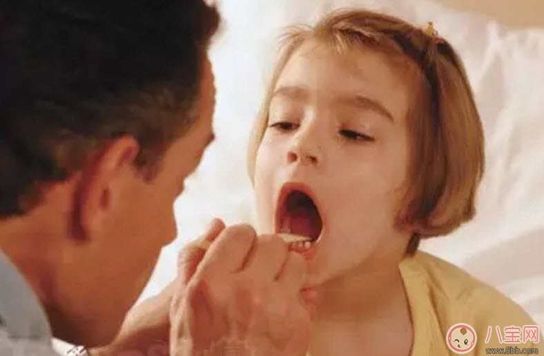 宝宝嗓子疼的原因有哪些 宝宝嗓子疼吃什么好