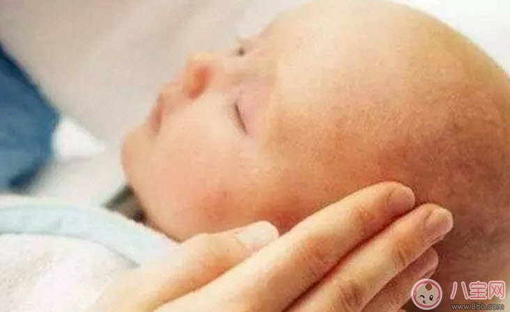 新生儿头上的乳痂一般什么时候消失 为什么有的宝宝长乳痂有的不长
