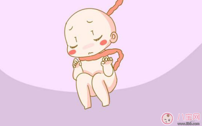 脐带绕颈怎么办 婴儿脐带绕颈严重吗