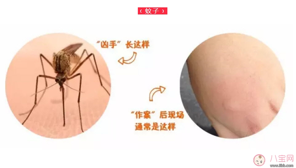 宝宝被蜱虫咬了症状图片 宝宝被蜱虫咬和蚊子咬症状对比图片区别