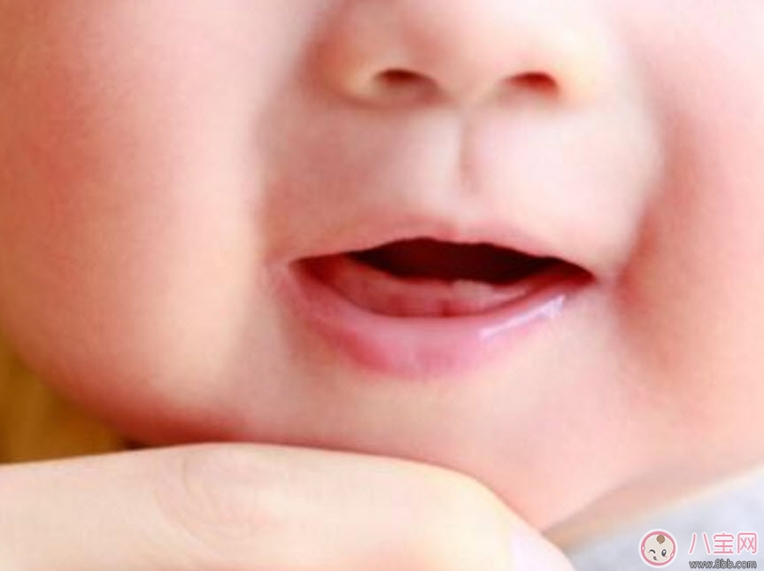 宝宝口腔溃疡原因有哪些 宝宝口腔溃疡怎么办吃什么好的快