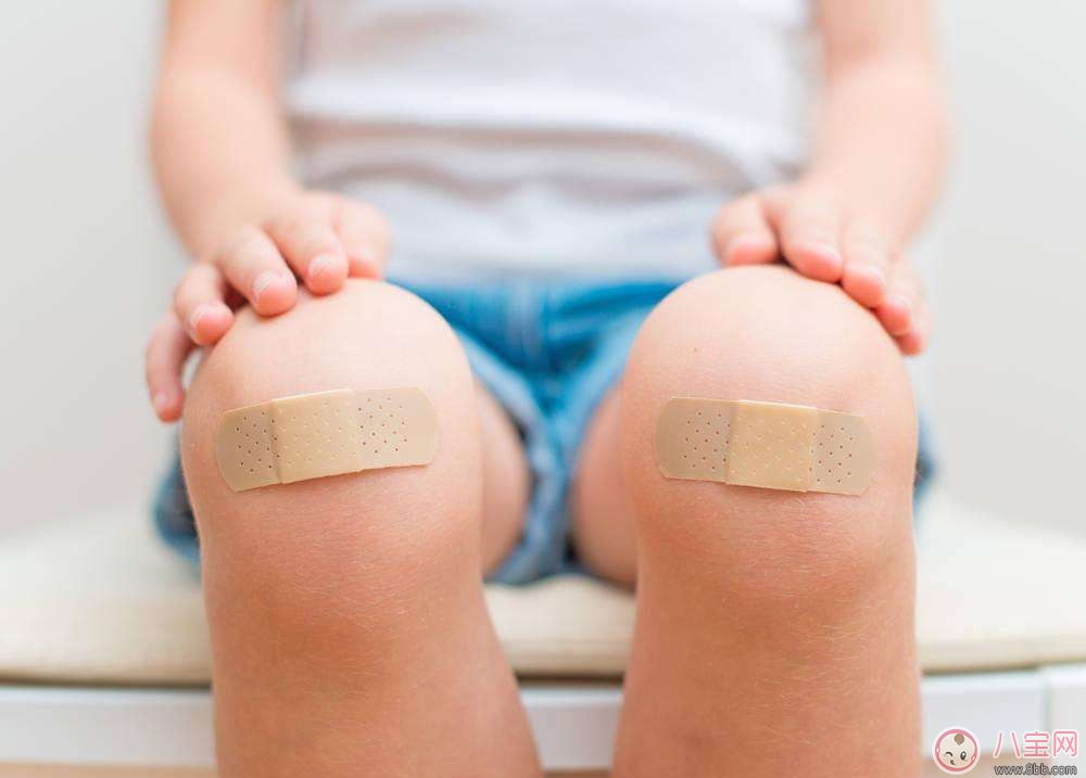 宝宝意外受伤伤口应该覆盖吗 如何正确处理伤口