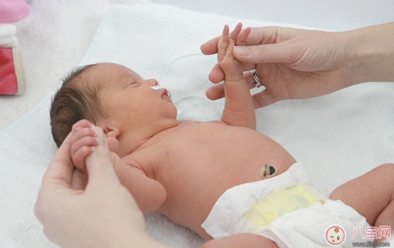 如何照顾新生儿的脐带 什么情况应该带宝宝就医治疗