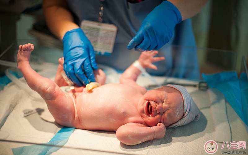 如何照顾新生儿的脐带 什么情况应该带宝宝就医治疗