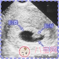 怀孕|怀孕6 7周未见胎心胎芽正常吗 胎芽胎心什么时候出现胎芽胎心对照表