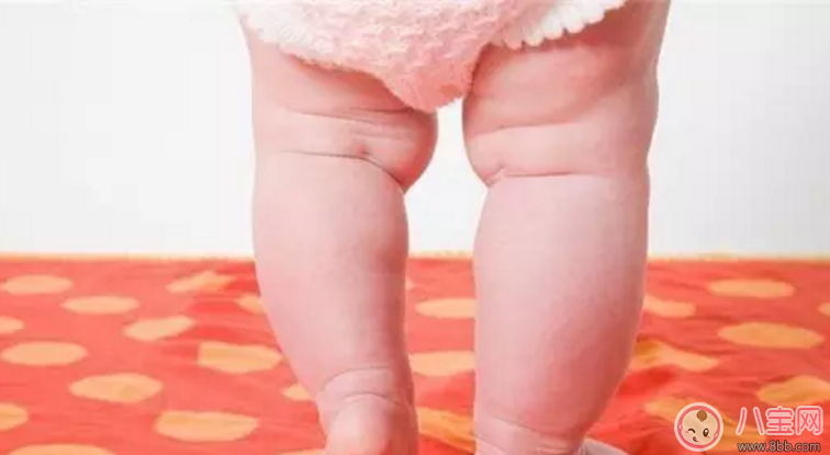 宝宝|六个月宝宝喜欢站会变成罗圈腿吗 宝宝太早学习站立会变成罗圈腿吗