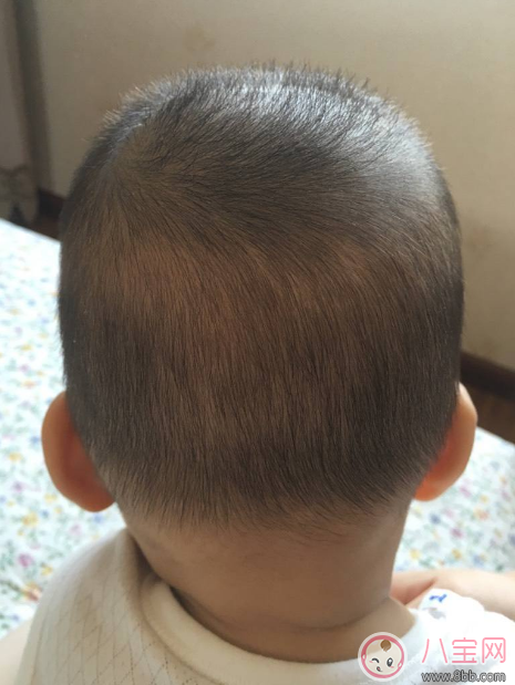 宝宝的头发怎么护理比较好 男宝宝女宝宝头发分别怎么护理