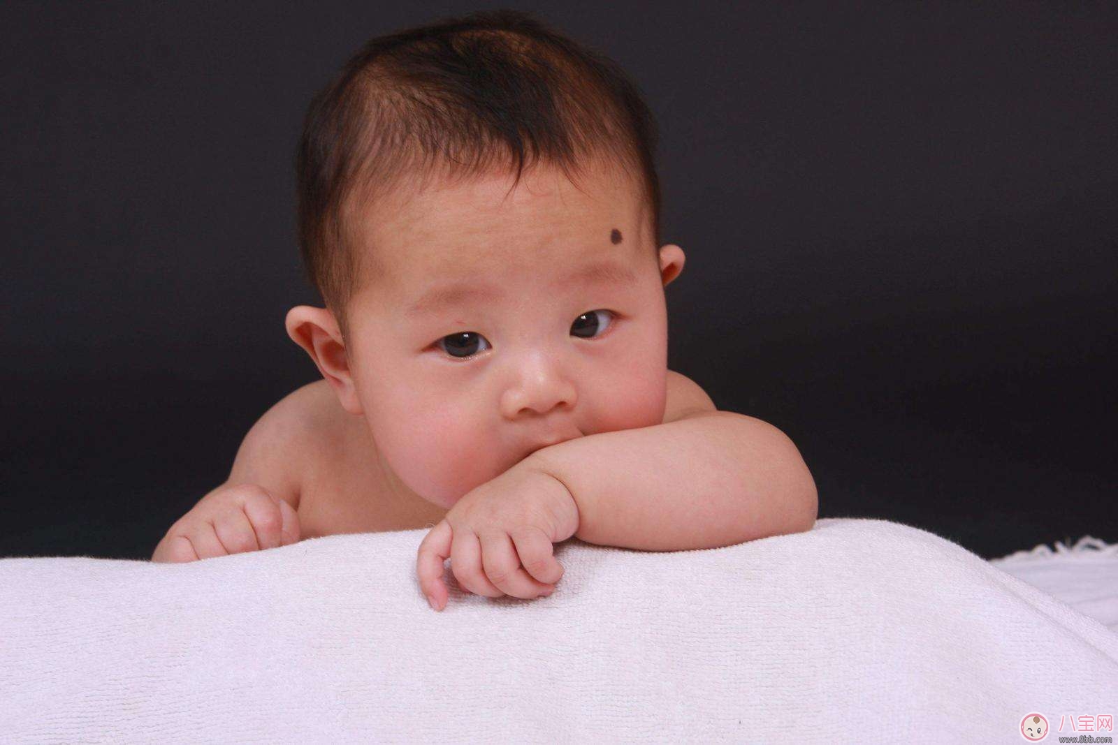如何认识孩子的胎记类型 宝宝什么胎记是疾病信号