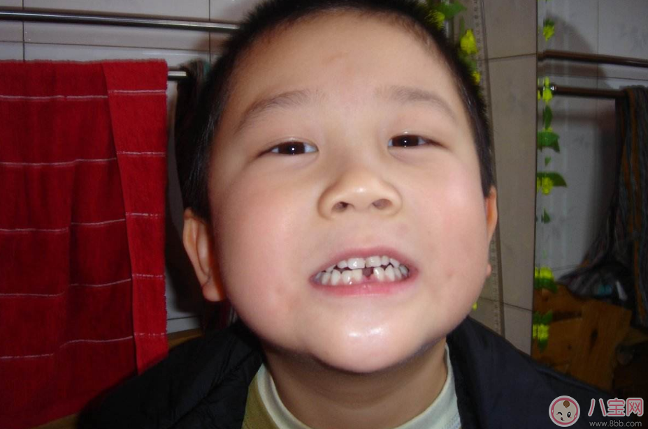孩子乳牙坏掉要补吗 孩子会长新牙所以不用管乳牙对吗