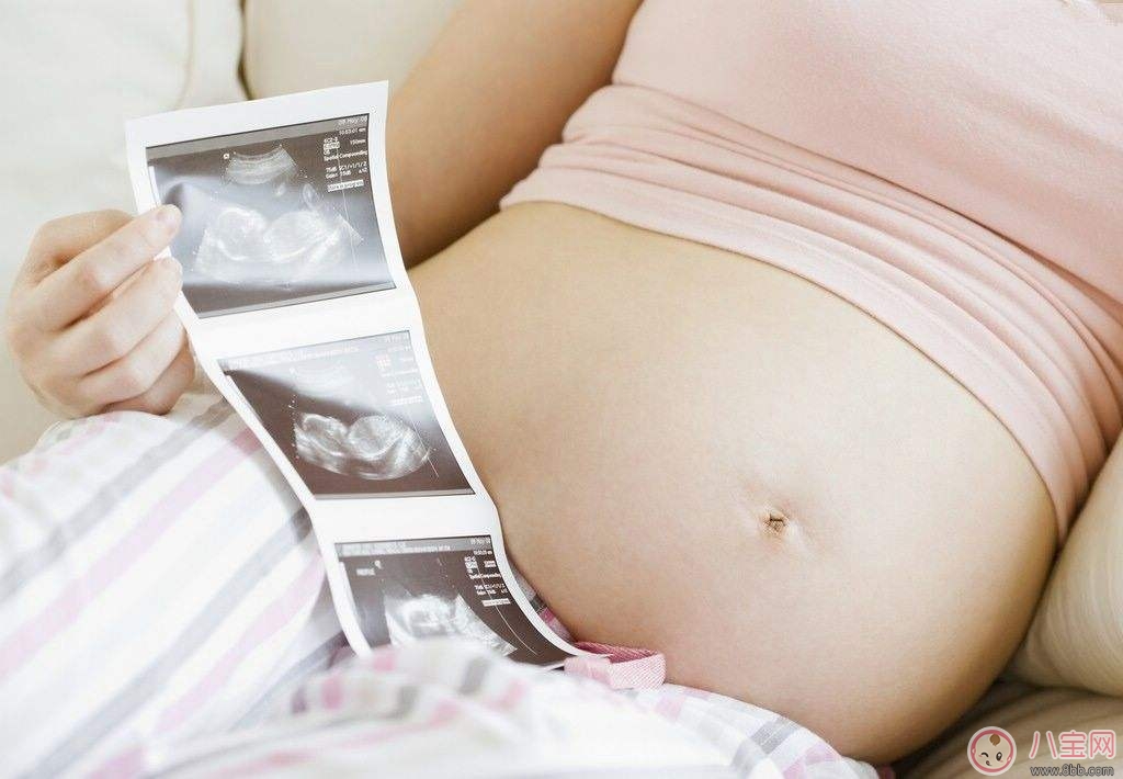 四维彩超检查什么 孕期什么时候做效果最好