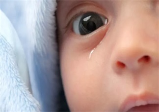 孩子眼屎多是不是眼睛有问题 孩子的眼屎太多怎么清理不伤眼睛