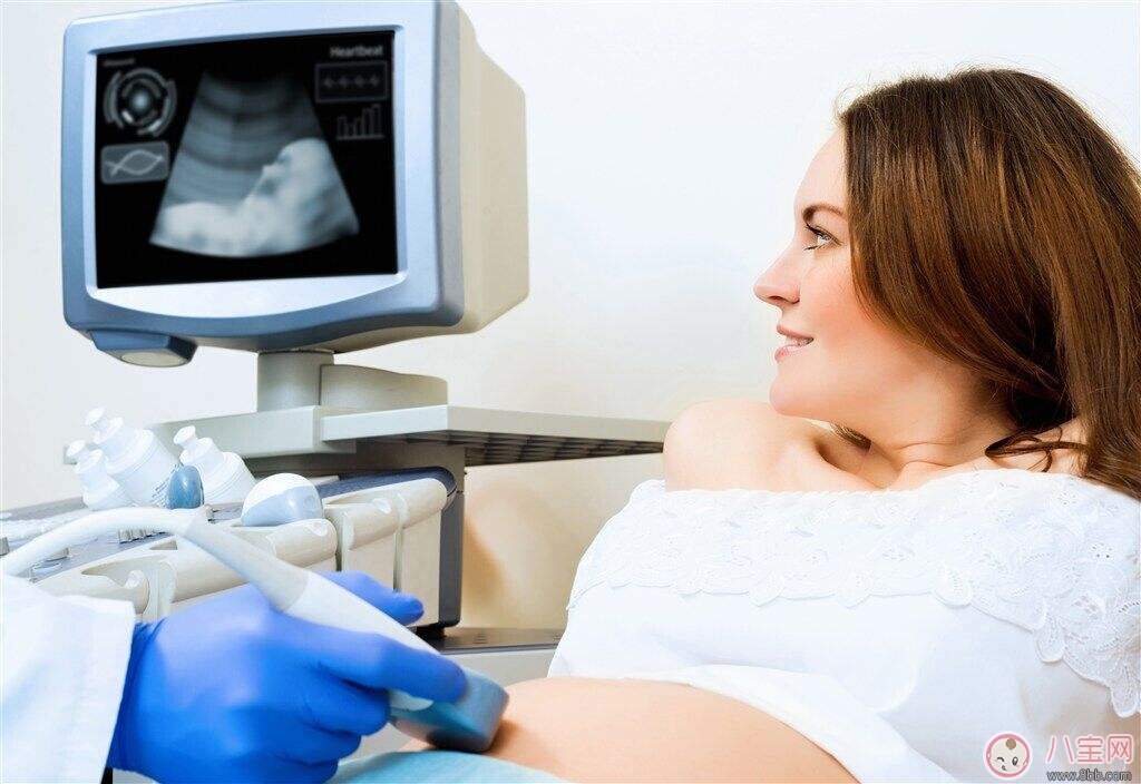 孕期非要做超声检查吗 什么是孕期超声标准检查