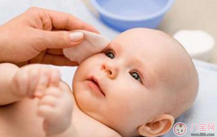 小孩眼屎太多糊住眼睛怎么办 给宝宝清洁眼睛的正确手法怎么做