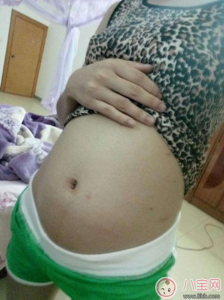 孕5月乳晕出水是怎么回事 怀孕乳房出水是正常的吗
