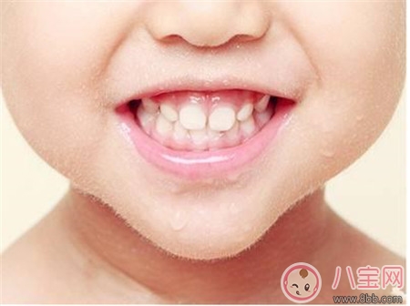 孩子蛀牙太疼怎么办 孩子蛀牙的原因是什么