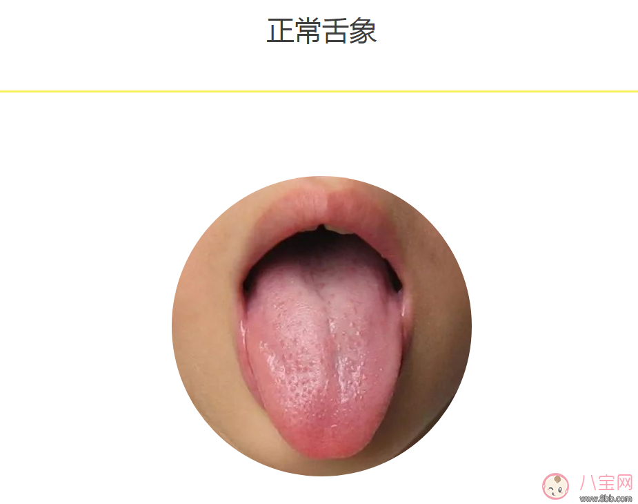 宝宝风寒感冒舌头什么样子 宝宝风寒感冒舌头和正常舌头对比图片