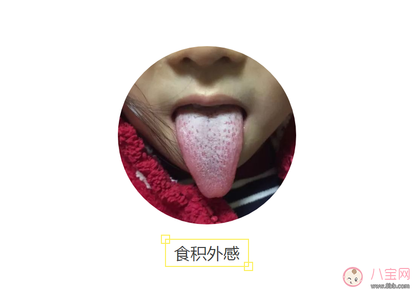 宝宝积食感冒舌头图片 怎么看宝宝是不是积食感冒有哪些症状