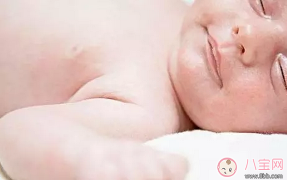 宝宝湿疹和遗传有关吗 宝宝湿疹和环境有关吗