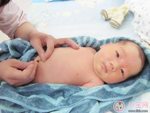 新生儿脐带护理方法 新生儿脐带护理有哪些要注意的