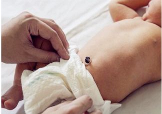 新生儿脐带护理方法 新生儿脐带护理有哪些要注意的