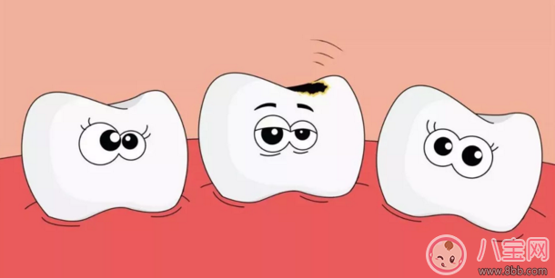 孩子蛀牙真的跟奶粉有关吗  如何预防孩子蛀牙