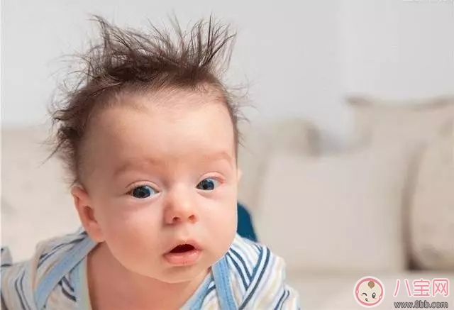 宝宝头发又黄又少怎么办  宝宝头发又黄又少是缺少维生素吗