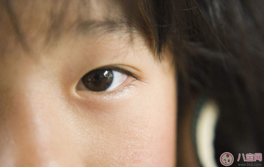 孩子的眼睛怎么做到从小保护好 孩子的视力不好怎么办