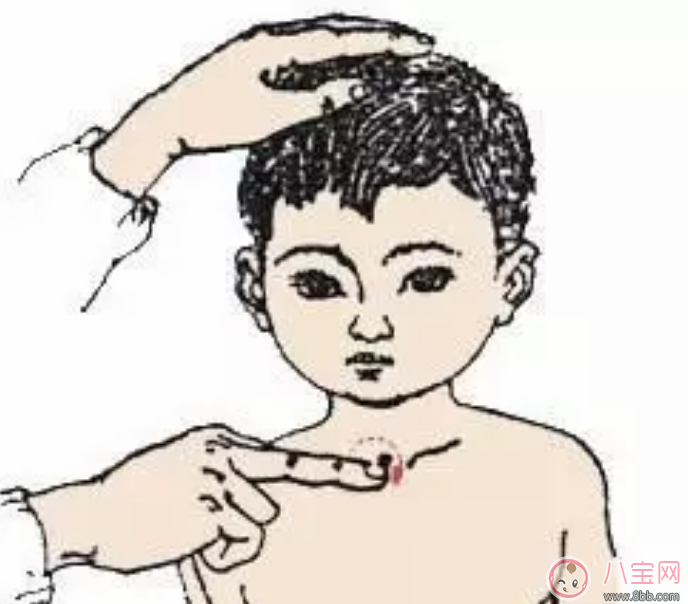 如何用艾灸提高宝宝免疫力 艾灸哪些穴位能增强小儿抵抗力