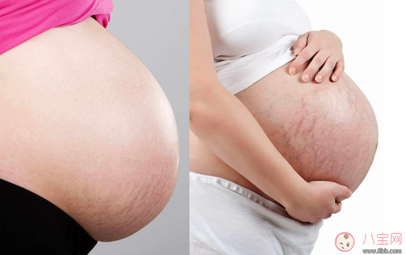 孕妇肚子形状像西瓜生女孩吗 孕妇肚子像西瓜生男生女