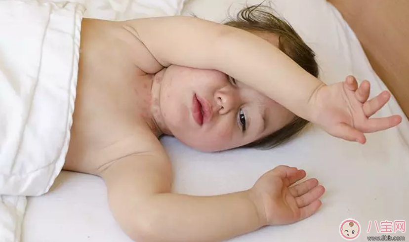 9个月宝宝有点歪脖子怎么回事 怎么判断婴儿歪脖子