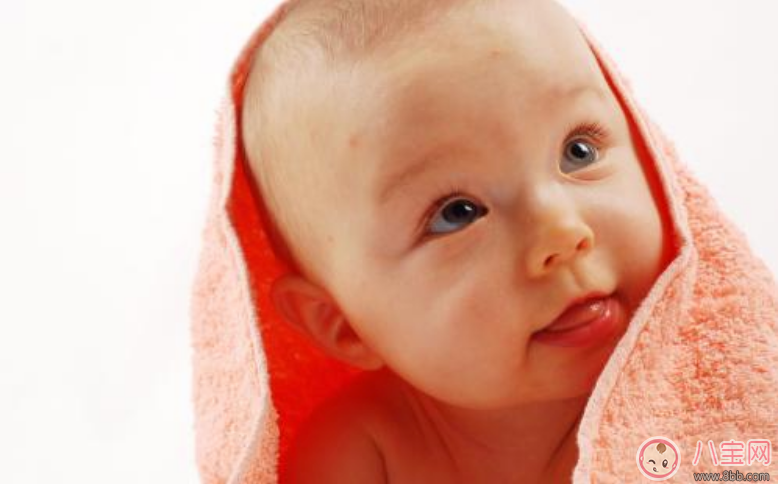宝宝的胎记是病吗 宝宝的胎记是怎样形成的