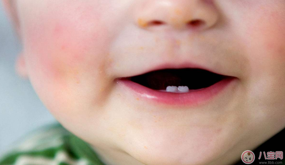 孩子什么时候会长出第一颗牙齿 孩子长牙规律分析