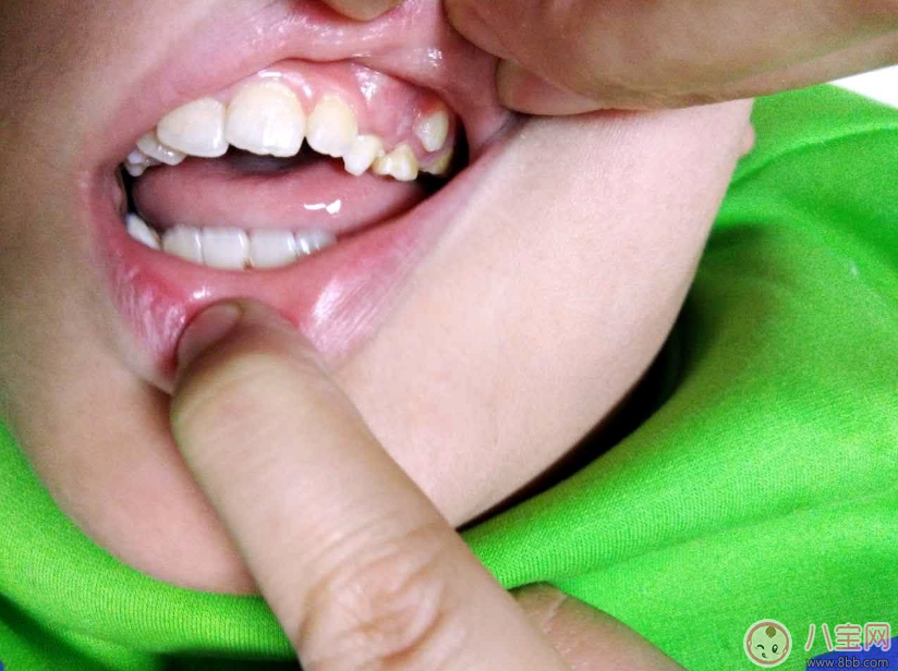 孩子换牙说话结巴怎么办 孩子换牙齿的时候不自信怎么安抚