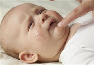 宝宝湿疹可以用激素药吗 宝宝湿疹用激素药的原则