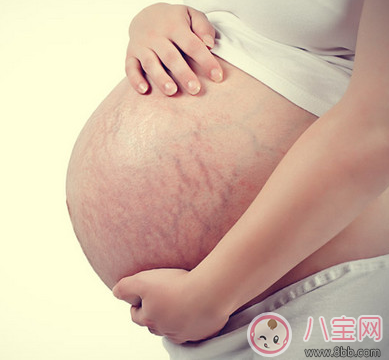 怀孕什么时候长妊娠纹 怎样有效预防妊娠纹