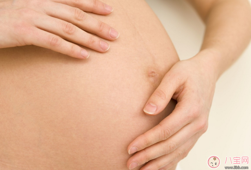 怀孕什么时候长妊娠纹 怎样有效预防妊娠纹