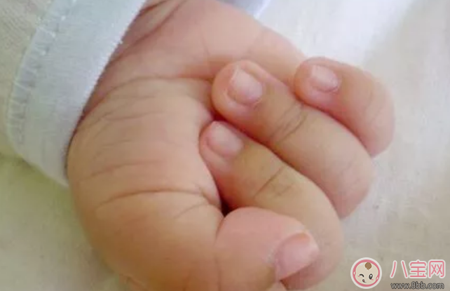 健康|小孩指甲有一个凹陷的小窝怎么办 宝宝手指盖上长小凹窝是什么原因