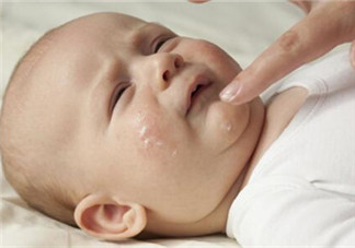 小孩湿疹反复怎么办 湿疹为什么会反复发作