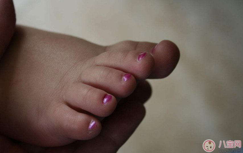 孩子指甲颜色异常是生病了吗 孩子指甲的颜色不对是什么原因