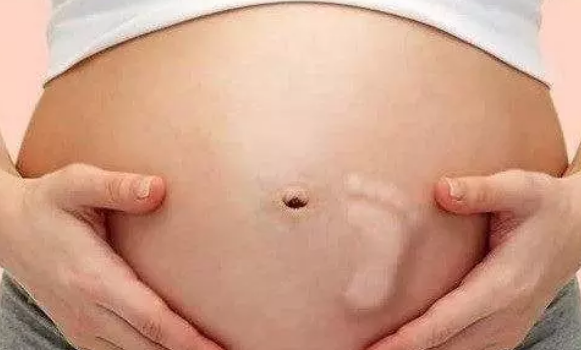 胎停育一般发生在什么时候2018 B超怎么看是不是胎停育